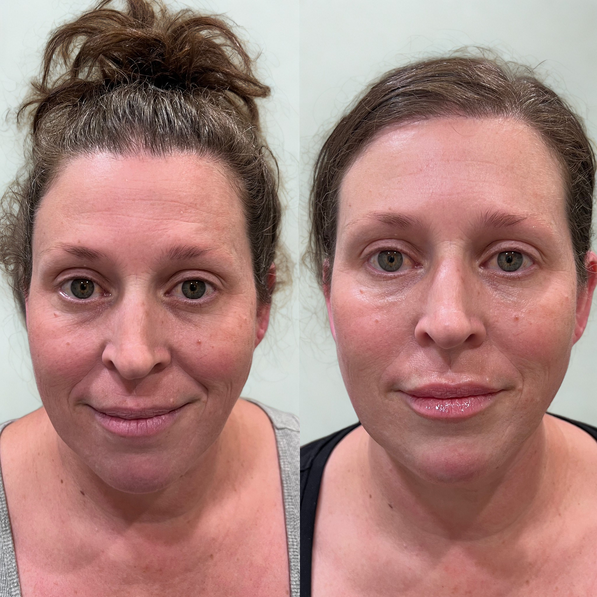 4A9D43F9-C140-4B6A-9635-A687659119CB