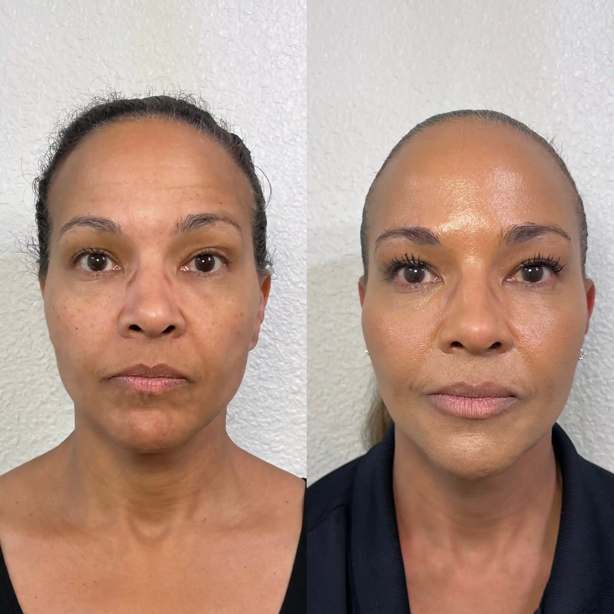Facial Balancing